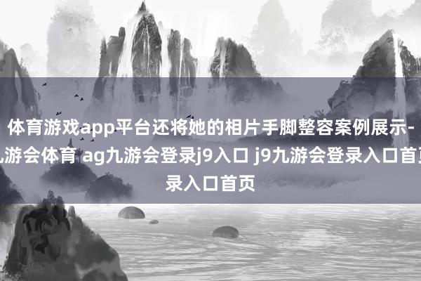 体育游戏app平台还将她的相片手脚整容案例展示-九游会体育 ag九游会登录j9入口 j9九游会登录入口首页